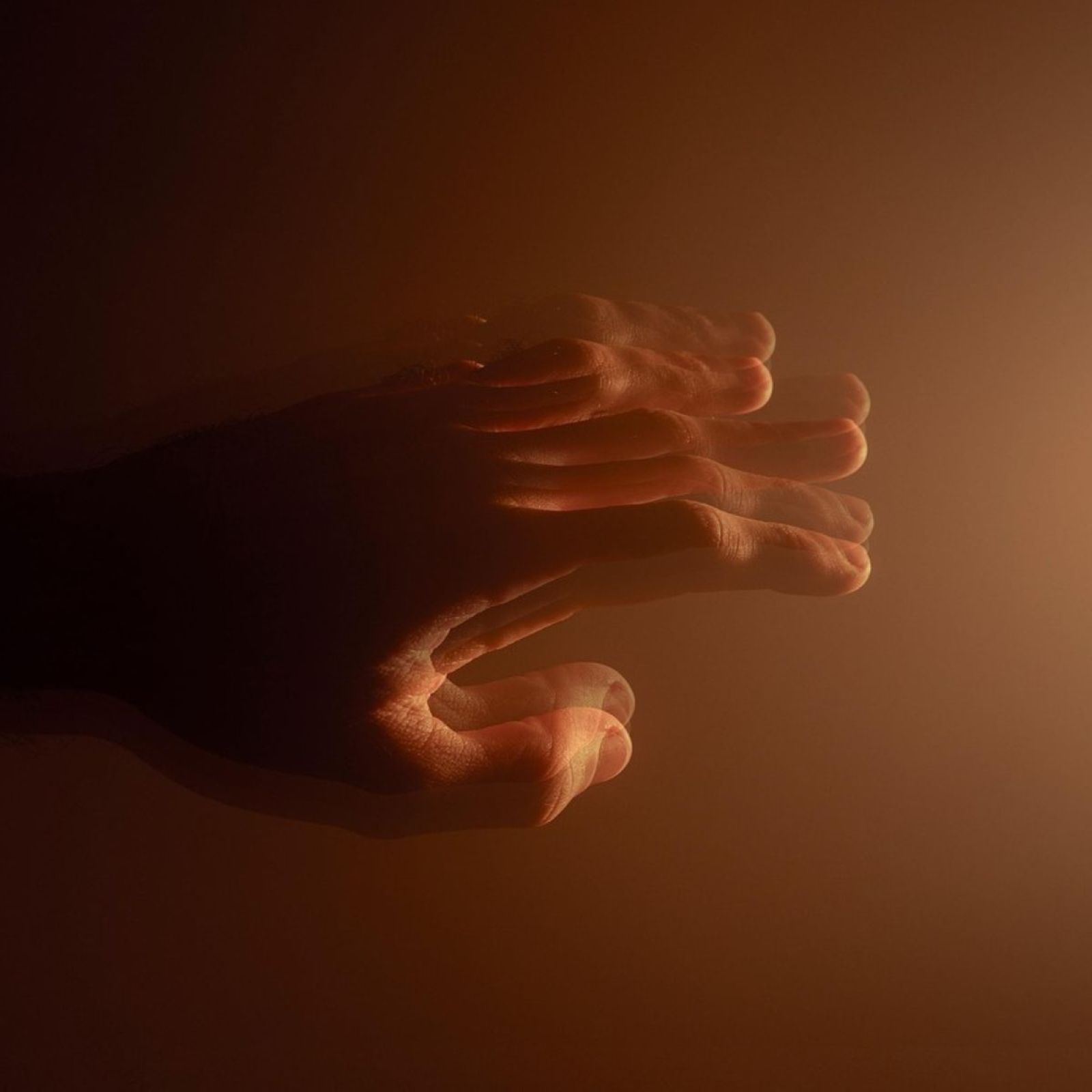 Parkinson’s Disease