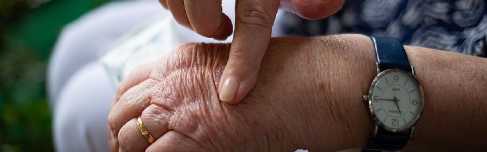 arthritis