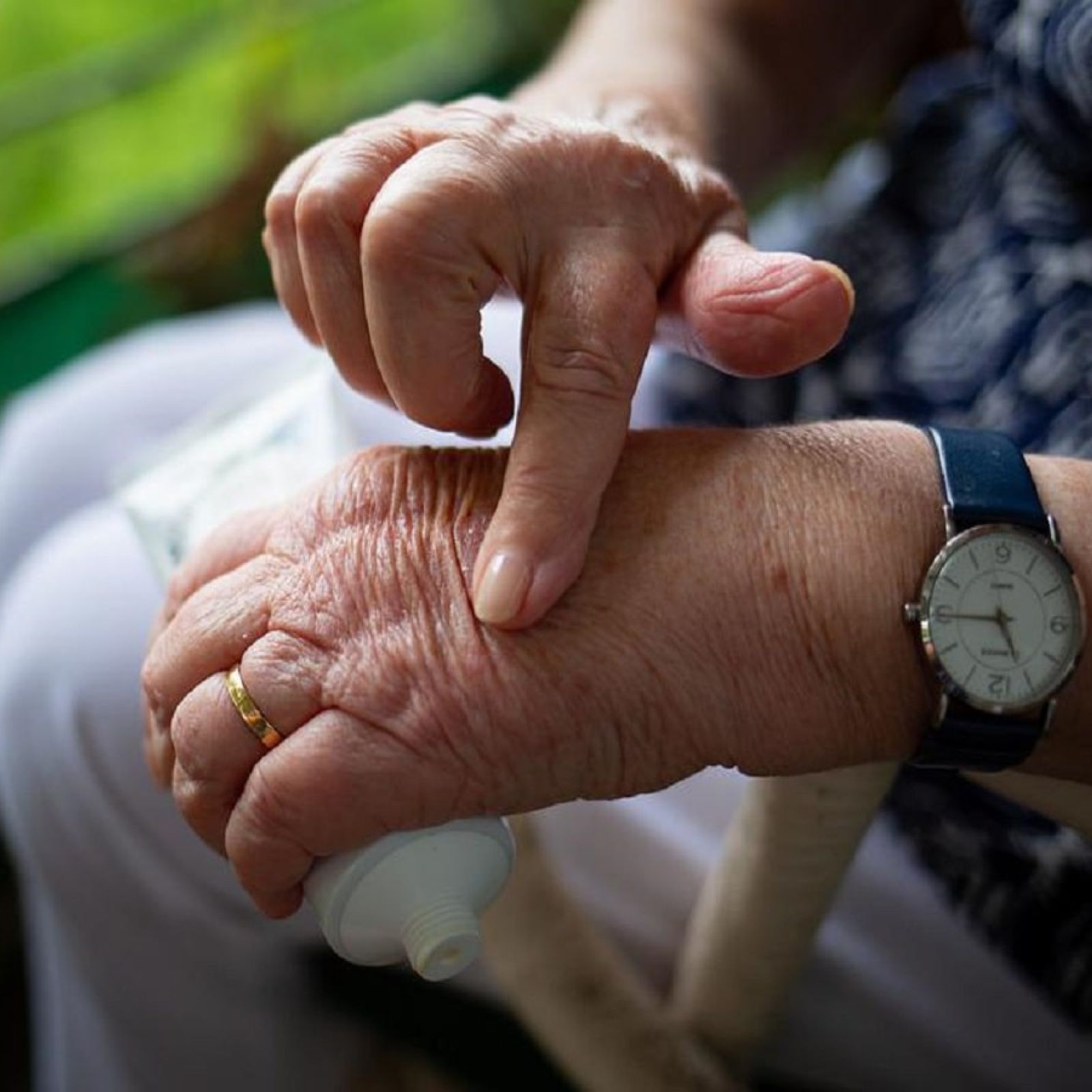 arthritis